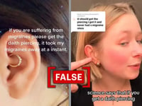 No scientific evidence supports the claim that daith piercings can cure migraines