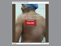 Photo of man in turban with bruises on his back falsely linked to farmers’ protest
