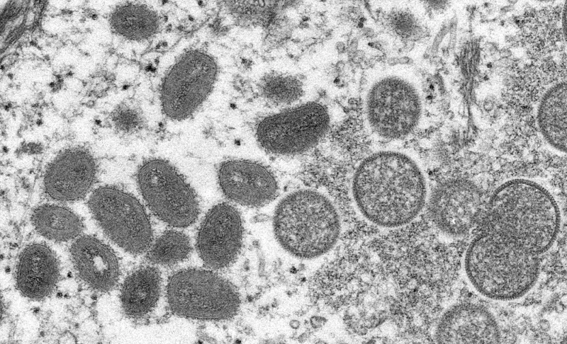 False: The monkeypox pathogen originated in U.S.-funded biolabs in Nigeria.