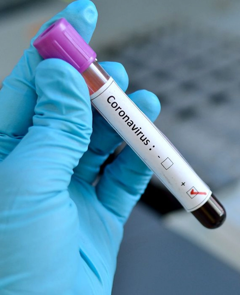 True: Arkansas has reported at least 2,276 confirmed coronavirus cases and 42 deaths.