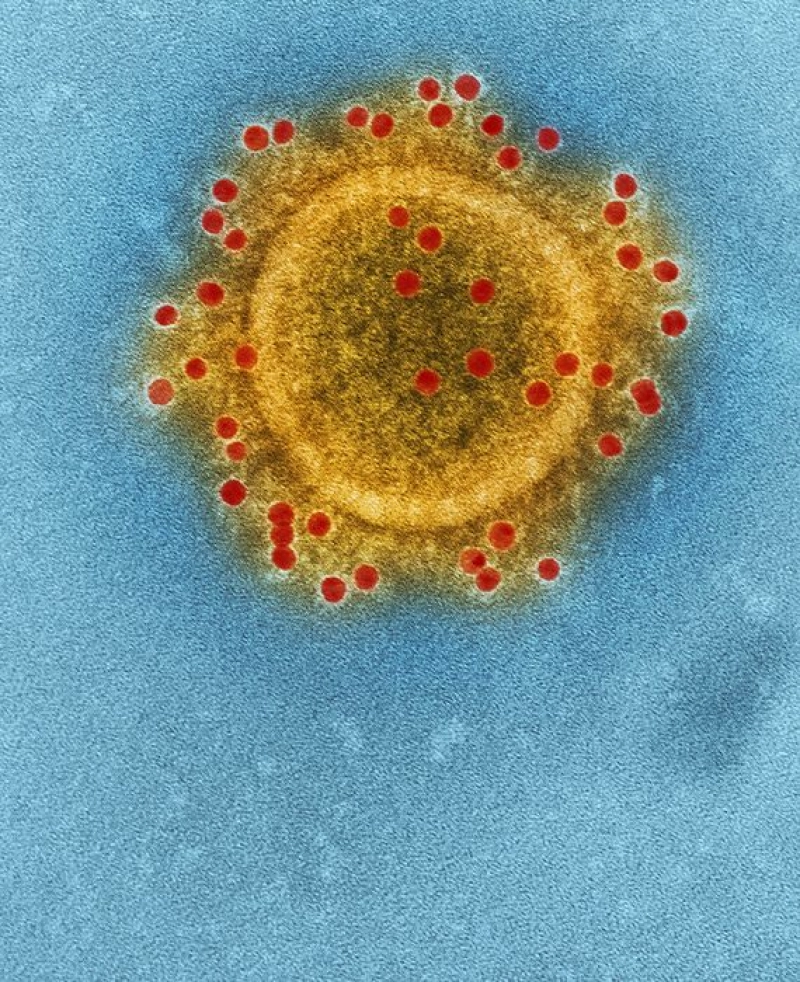 False: Dr. Tasuku Honjo has called COVID-19 a man-made virus.